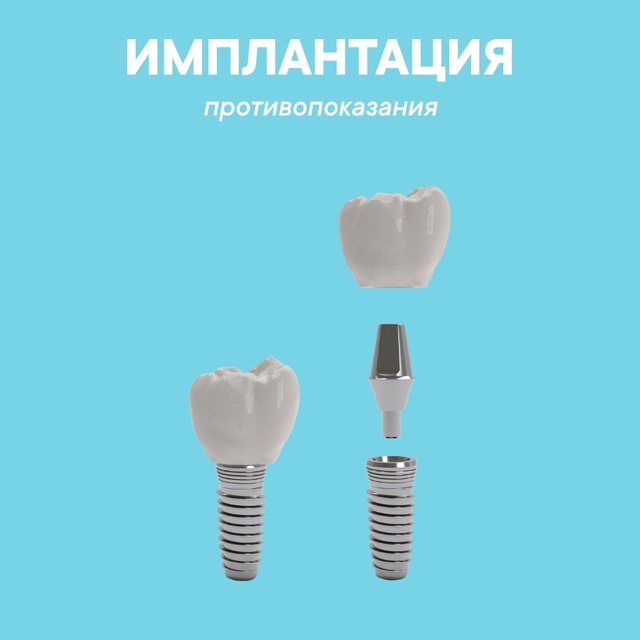 Что нужно знать о противопоказаниях к установке зубных имплантов?