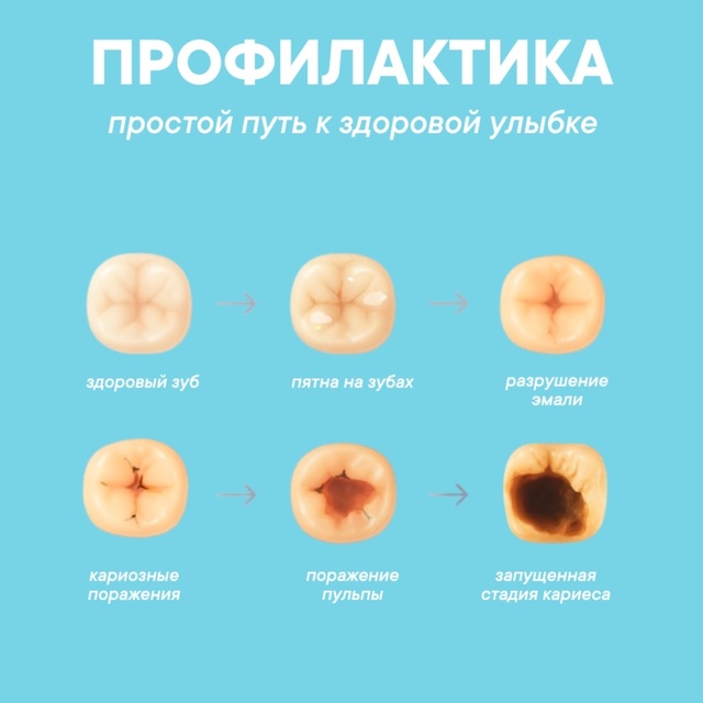 Профилактика