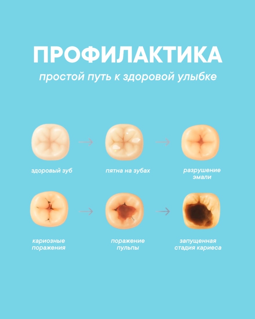 Профилактика